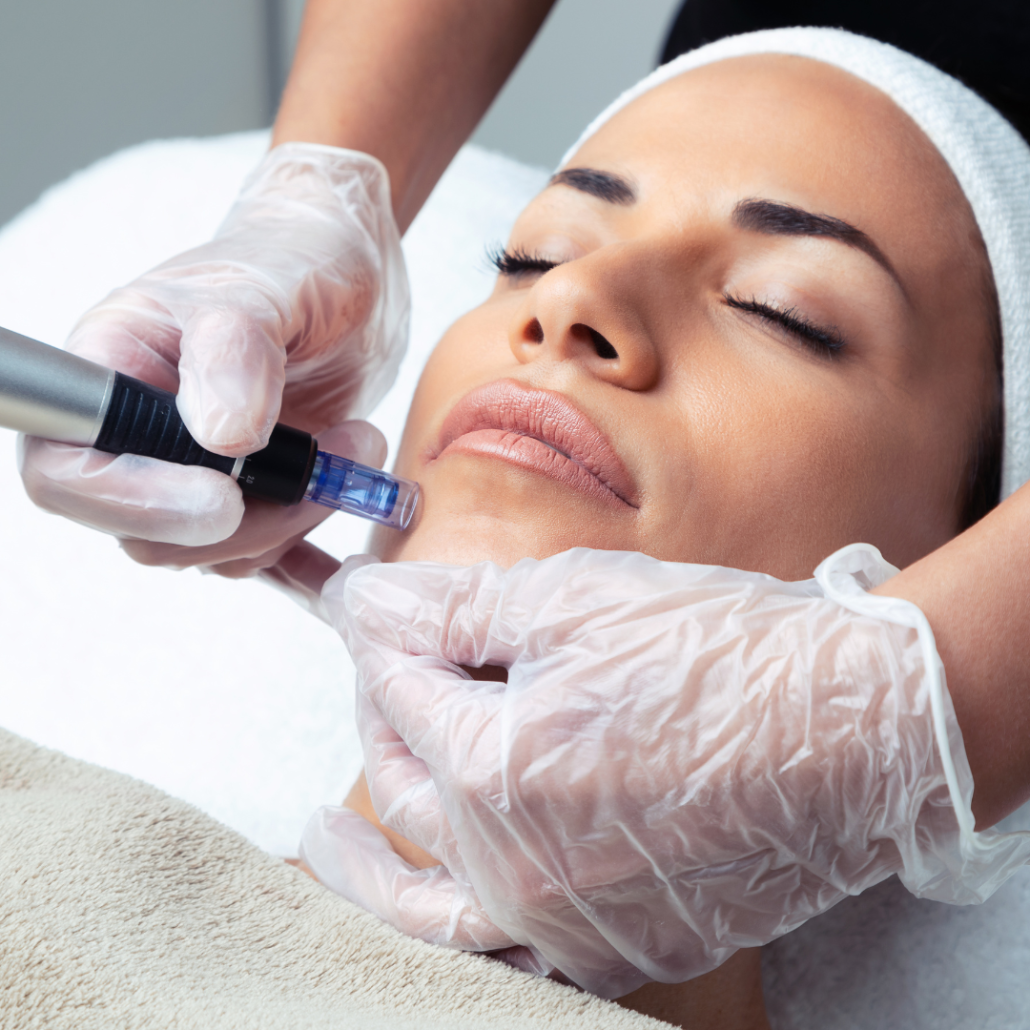 microneedling durban eazy slim website 1